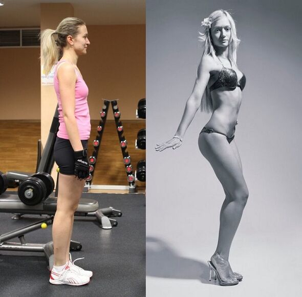 antes e despois do aumento mamario corrixindo a postura